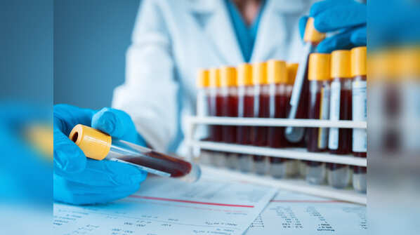 How plasma therapy helps Covid19 patients