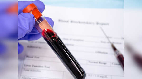 What to do before donating plasma