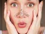 Looking to remove those blackheads from your face? Keep these Dos and Don'ts in mind