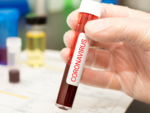​Asymptomatic coronavirus carriers: What do the reports say