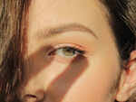 ​Eye infection