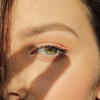 ​Eye infection