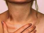 Try these hacks to get rid of your hickey marks than covering with makeup or scarf