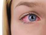 Can treat dry eyes