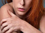 Simple ways to deal with eczema during summers