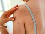 Body acne can be very painful