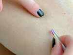 These tips will ensure to prevent ingrown hair in your skin