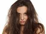 Is summer season ruining your hair? Try these natural remedies