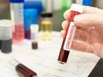 Coronavirus treatment latest update: AstraZeneca’s blood cancer drug shows great promise in COVID treatment, ICAR claims herbal extracts may treat coronavirus patients