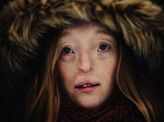 Rare facial defect doesn't stop this German model Ilka Brühl from dreaming big