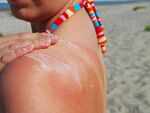 Protect your skin from sun damage