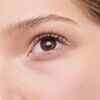 Reduces acne