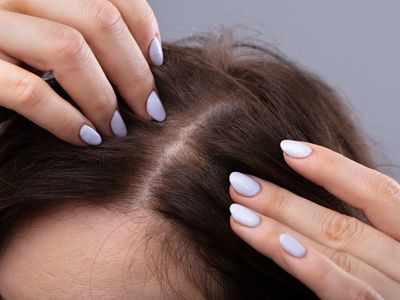 Tired of itchy pimples on your scalp? Here's what you can do to treat them  | The Times of India