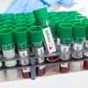 Vaccine trials are underway