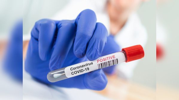 Sinovac Biotech has already started Phase 3 trials of CoronaVac