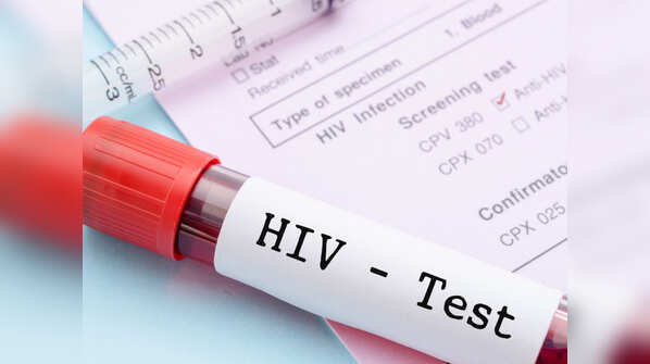 Learning lessons from battling the HIV-AIDS pandemic