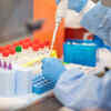 Officials conduct serosurveillance tests across Delhi