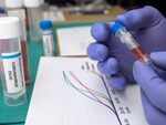 Coronavirus can impact your heart health in more ways than one