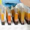 If not vaccine, what else?