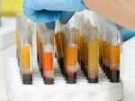 Some people more eligible to donate plasma than others