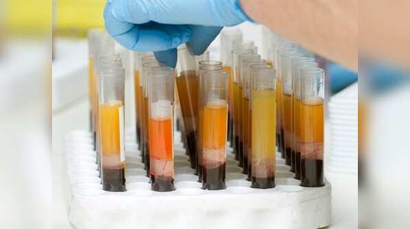 Some people more eligible to donate plasma than others