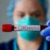 India is yet to reach COVID-19 peak: AIIMS director