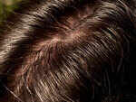 For oily scalp