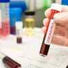 Is it more transmissible and infectious?