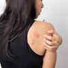 ​Rash, hives or chicken pox-like lesions