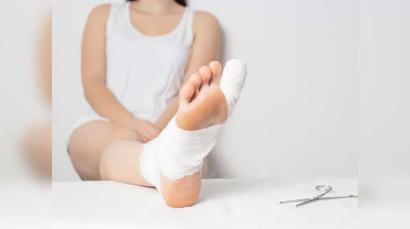 Purple toe rash
