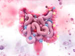 ​Risk factor for colon cancer