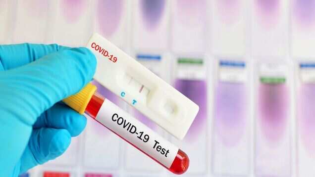 Mumbai: International passengers to go through COVID-19 test at the airport