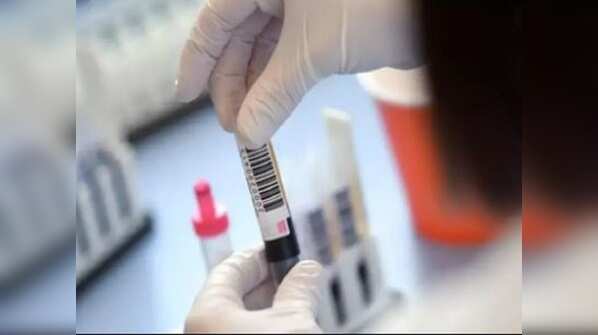 How was the ICMR study conducted
