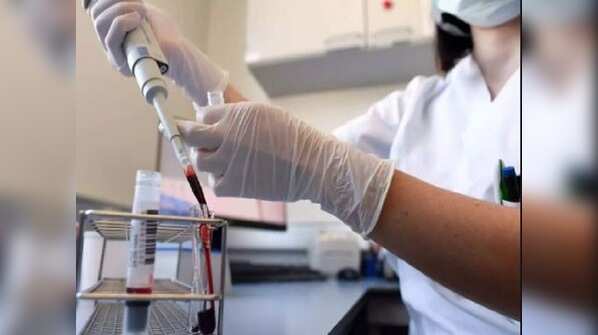 “Plasma therapy helps those in stage 1 and 2 of the disease”