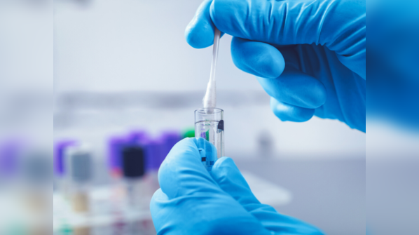 How does the RT-PCR test diagnose COVID-19