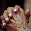 Nails look clubbed