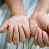 Horizontal lines across your nails