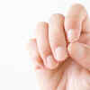 Dry, weak or cracked nails