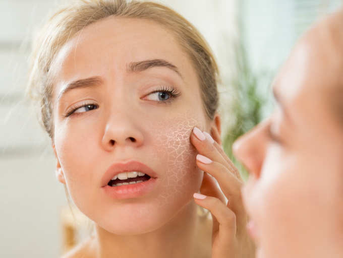 Suffer from very dry skin? These are the reasons! | The Times of India