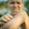 Article image for: Keep your hands off of bug bites, blackheads and injuries