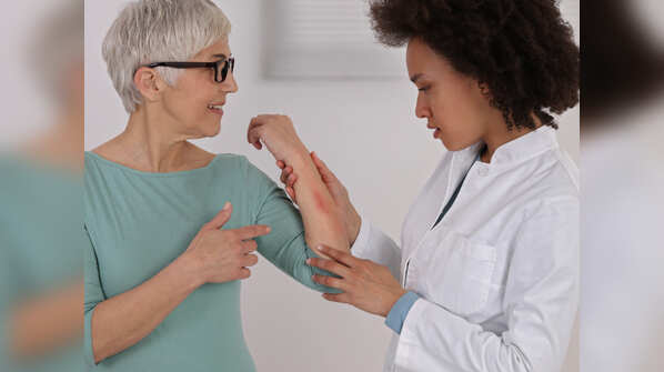 Consult a dermatologist about high-tech options