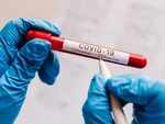 You get tested too early