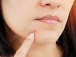 Your pores must be blocked