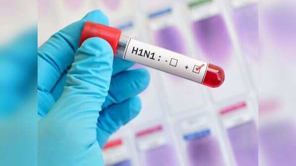What is Swine Flu?