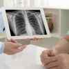 Patients diagnosed with chest lesions and scarring