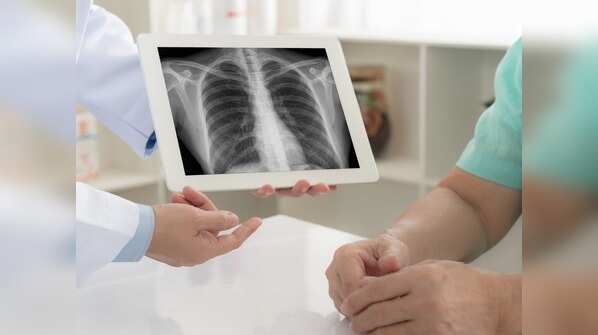 Patients diagnosed with chest lesions and scarring
