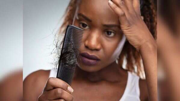 Eat these foods to prevent hair fall