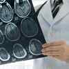 How could it be related to COVID-19?