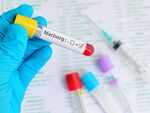 Marburg Virus disease