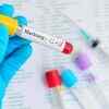 Marburg Virus disease